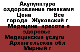 Акупунктура, оздоровление пиявками › Цена ­ 3 000 - Все города, Жуковский г. Медицина, красота и здоровье » Медицинские услуги   . Архангельская обл.,Мирный г.